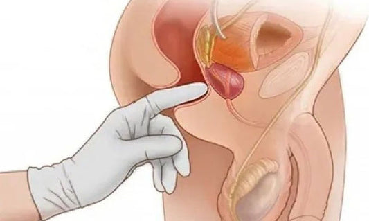 新手前列腺開發指南 - 前列腺位置在哪？如何前列腺高潮？